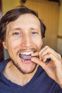 Man wearing nightguard to prevent teeth grinding and clenching