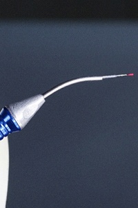 Close-up of soft tissue laser used for frenectomy