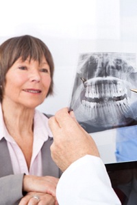 Oral surgeon explaining X-ray to an older couple.