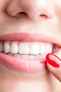 Closeup of patient pointing to smile