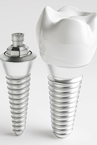 Dental implant, restoration, and abutment against gray background