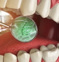 digital illustration showing bacteria in a mouth
