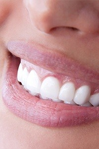 Closeup of healthy smile