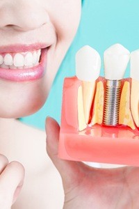 woman holding dental implant model