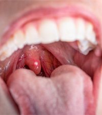 closeup of a uvula 