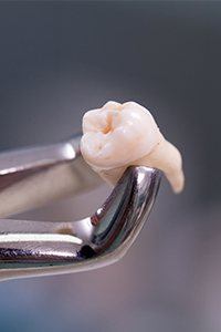 Clasp holding extracted tooth