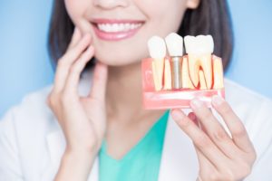 Smiling dentist holds model jaw with dental implants