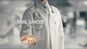 Physician and oral cancer